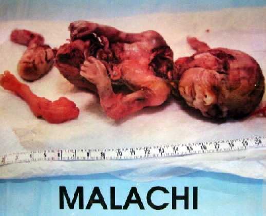 Abortion-malachi
